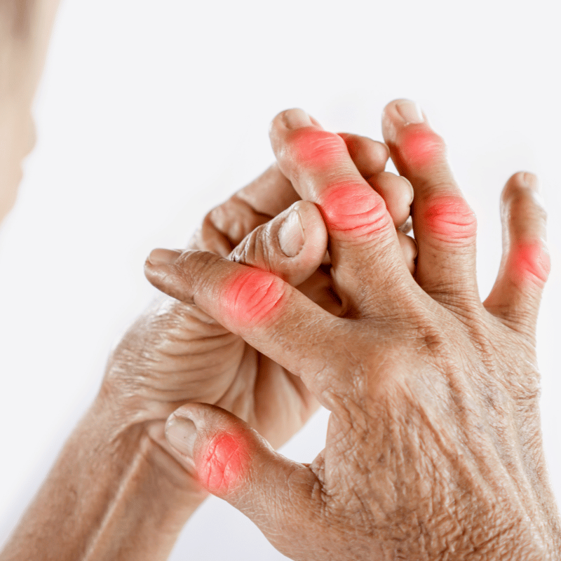 Gout Clinic Gout Clinic